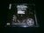 MUTIILATION - Destroy your Life for Satan. CD