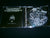 PUTRID YELL / SOULROT - Putrid and Rotten: Past Life Horrors. Split CD