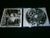 CADAVER / CARBONIZED - Scandinavia Special 1. Split CD
